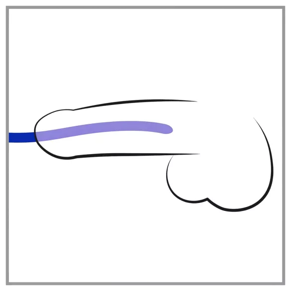 You2Toys - DILATOR - szilikon dilátor szett (3 db)